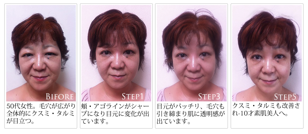 美整筋メソッド®※背中・デコルテ・頭蓋骨マッサージ付